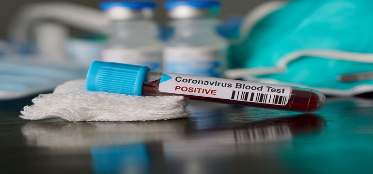Wow! Virus Corona di Amerika Kini Lampaui 8 Juta Kasus!