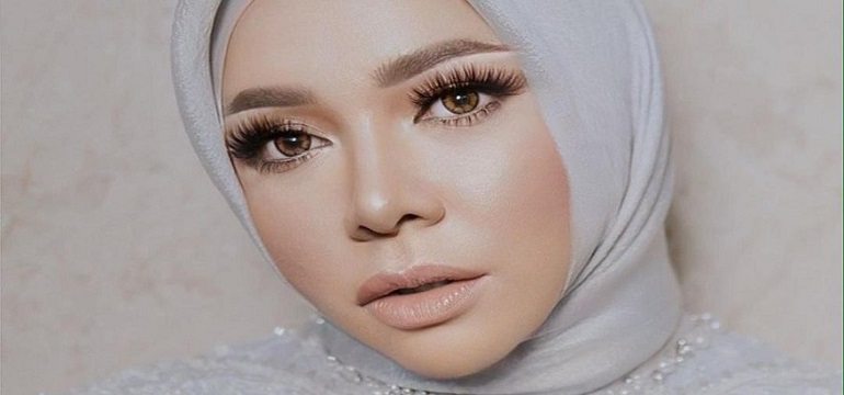 Apa Itu Bariatric? Istilah Dalam Dunia Operasi yang Dilakukan Artis Melly Goeslaw